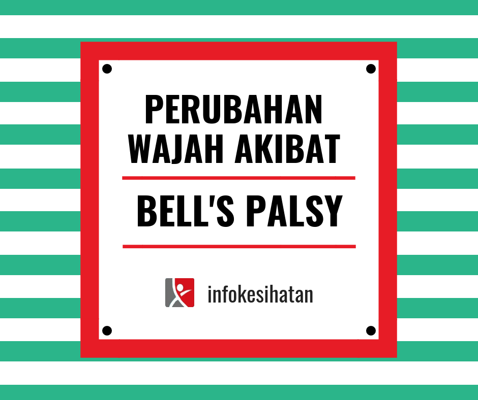 “Ingat!! Bell’s Palsy Bukan Gejala Stroke!”