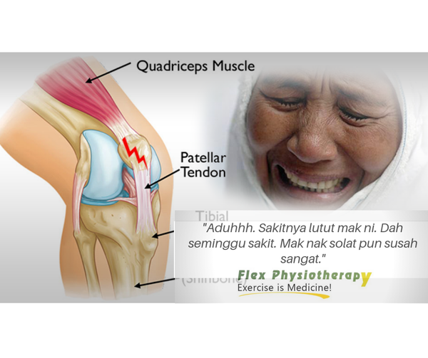 Hilang sakit lutut lepas rawatan fisioterapi