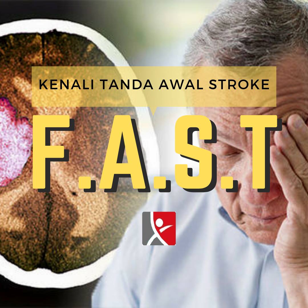 Tanda awal stroke: F.A.S.T Sebelum Terlambat