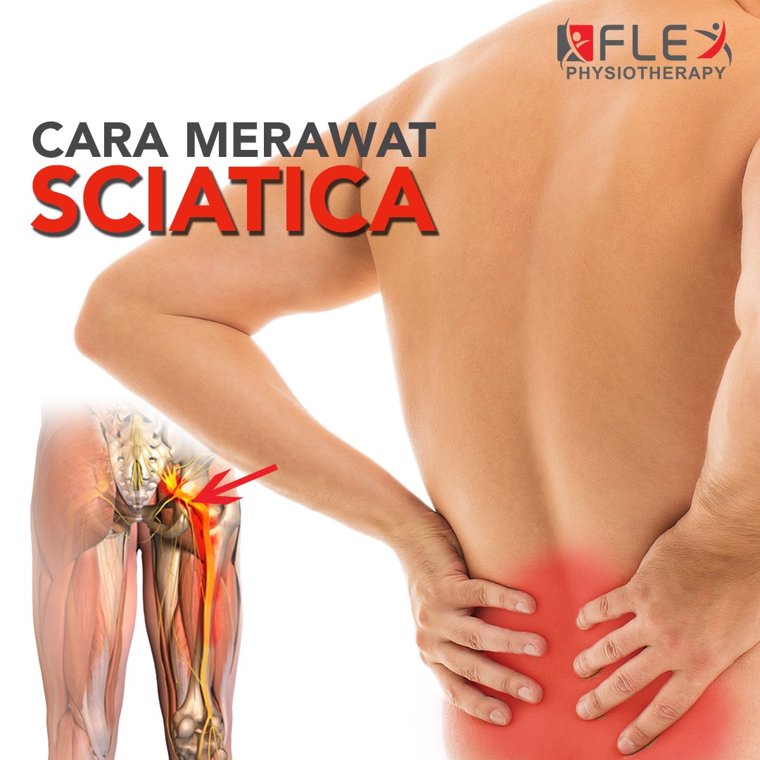 Sciatica punca kaki kebas rupanya