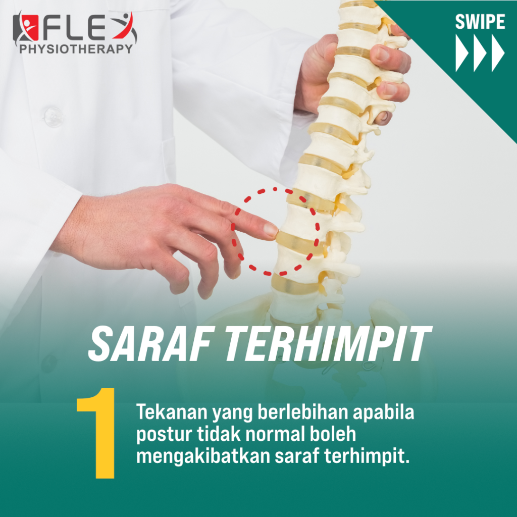 Saraf Terhimpit Kesan Daripada Scoliosis